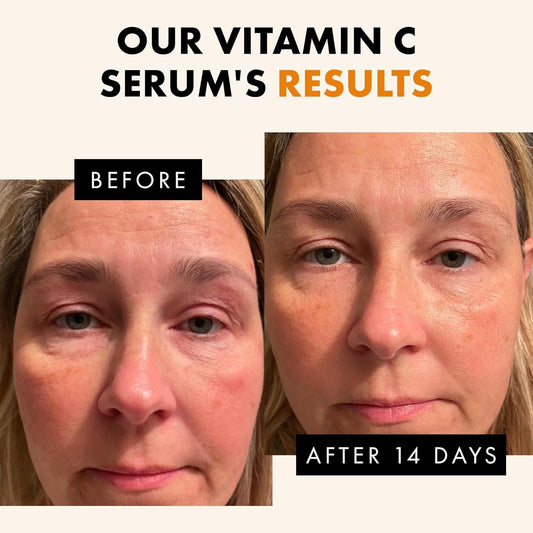 Eclat Skincare Vitamin C Face Serum - Skin Care for Dark Spots, Vitamin C Serum with Hyaluronic Acid, Ferulic Acid, & Vit E - Anti Aging and Skin Brightening, Pure Vit C Facial Care - 30 ml
